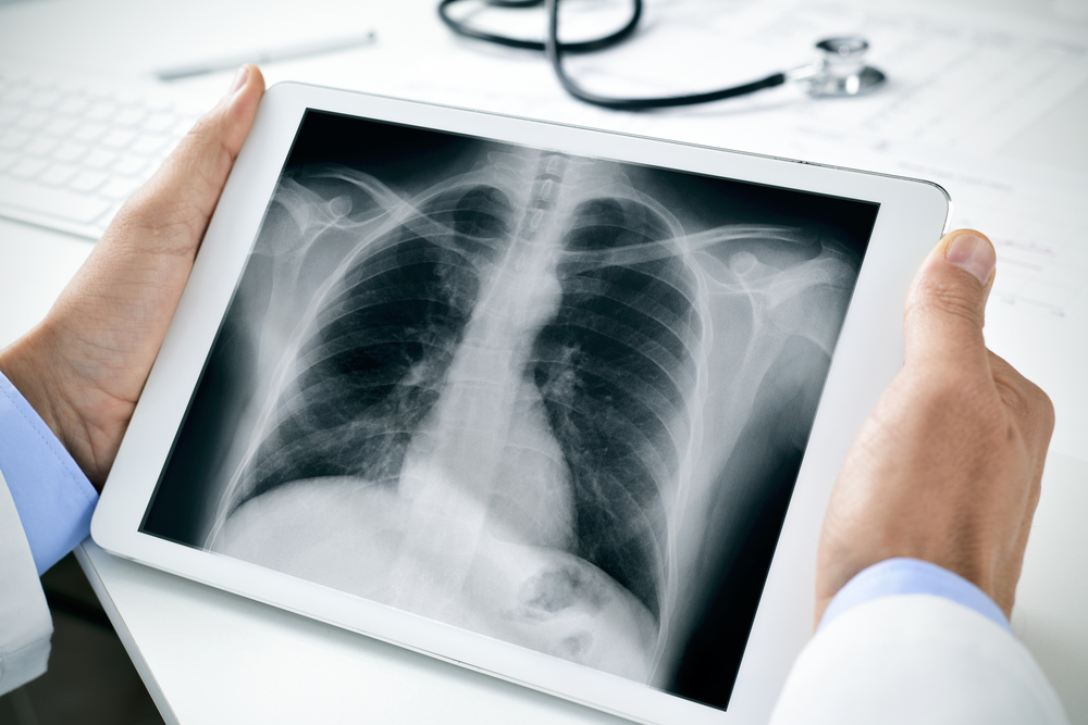 X-Rays In Mobile, AL | Alabama Coastal Radiology, P.C.